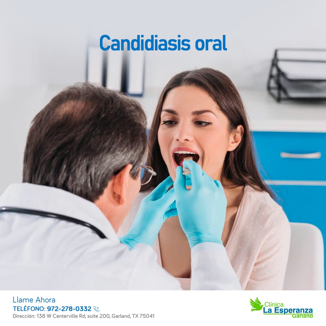 Candidiasis oral