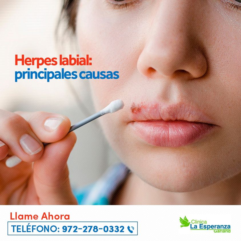 Principales Causas Del Herpes Labial 0392