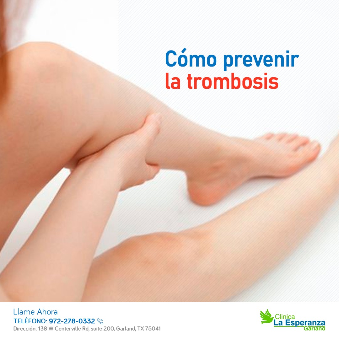 ¿Cómo prevenir la trombosis?