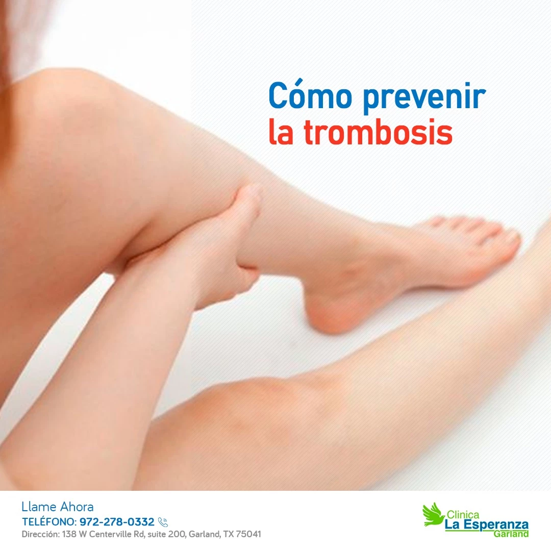 ¿Cómo prevenir la trombosis?