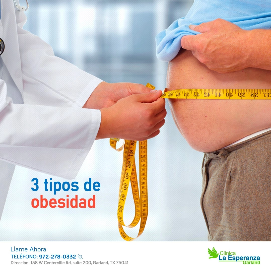 3 tipos de obesidad